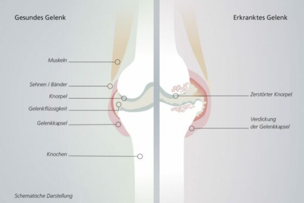 arthrose-hund-grafik-gelenk